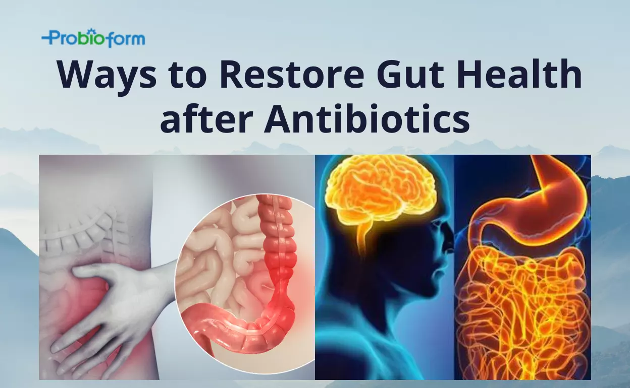 Ways to Restore Gut Health after Antibiotics